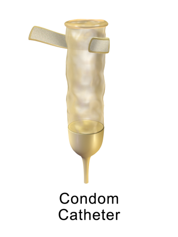قسطرة كندم صيني ميديم - Condom Catheter Chinese Medium